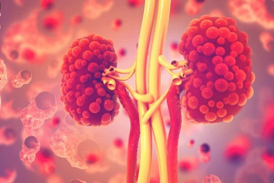 Những người &quot;luôn luôn&quot; thêm muối vào thức ăn tại bàn ăn có nguy cơ mắc bệnh thận mạn tính tăng 29%. Ảnh: Shutterstock