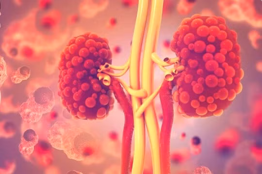 Những người "luôn luôn" thêm muối vào thức ăn tại bàn ăn có nguy cơ mắc bệnh thận mạn tính tăng 29%. Ảnh: Shutterstock