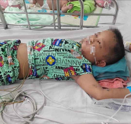 3 con của chị Lượng bị đốt hàng chục mũi Ảnh: Ly Trương