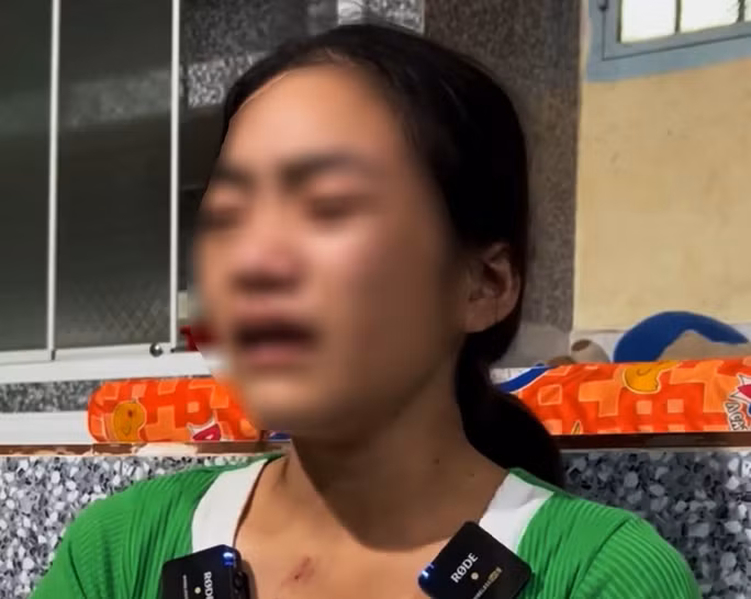 Em N.T.B.V. kể lại việc bị chủ đánh đập dã man khi đi làm thuê trong nước mắt