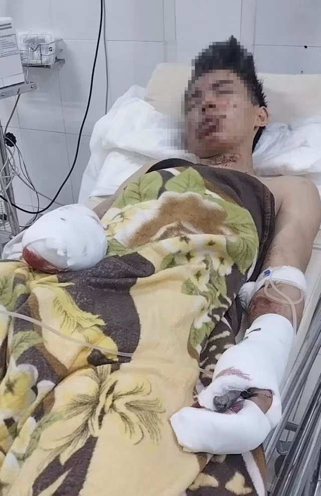 N.T.H đang điều trị tại Bệnh viện đa khoa Đà Nẵng