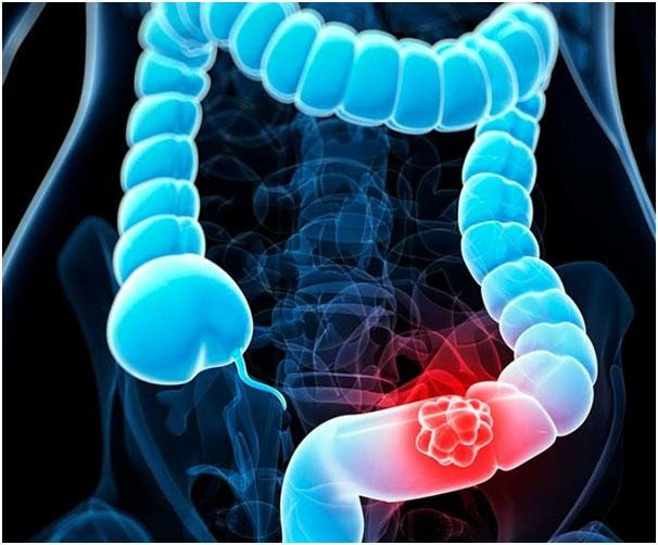 Ảnh minh họa. Ảnh minh họa.