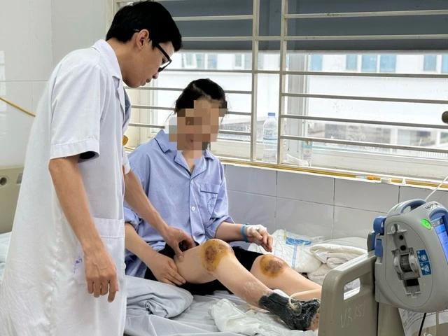 Các bác sĩ điều trị cho nữ bệnh nhân biến dạng khớp gối, hoại tử bàn chân sau khi dùng ong đốt để điều trị viêm khớp.