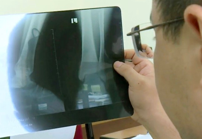 Trinh sát kiểm tra một phim X-Quang giả.