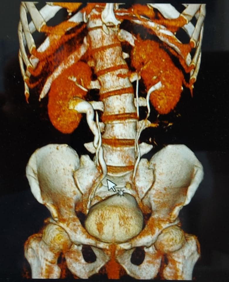 Hình ảnh bất thường trên kết quả chụp của người bệnh. Ảnh: BV