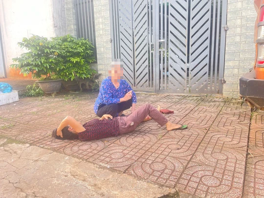 Người phụ nữ bị chó cắn, kéo lê trên đường - Ảnh 1. Người phụ nữ bị chó cắn, kéo lê trên đường gây thương tích