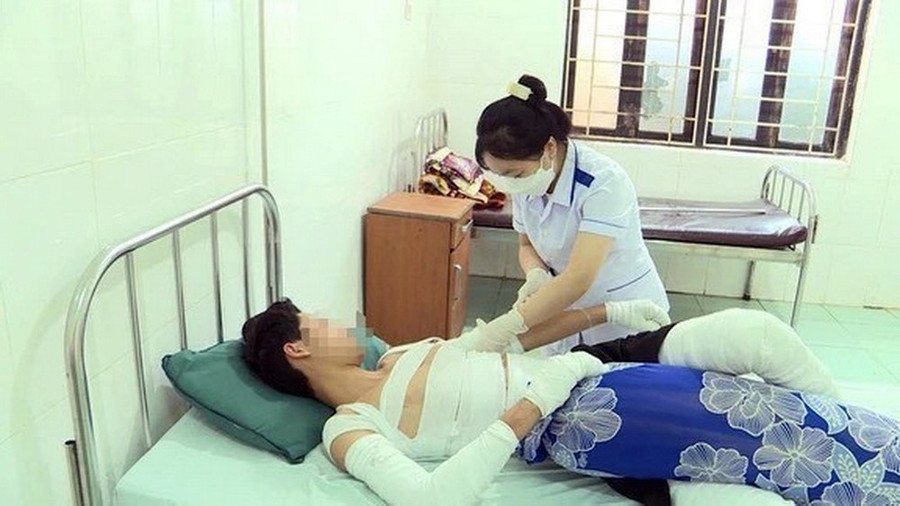 Một thiếu niên tại trú tại huyện Đắk R’lấp, tỉnh Đắk Nông bị bỏng nặng khi tự chế tạo pháo. (Ảnh: TTXVN phát)