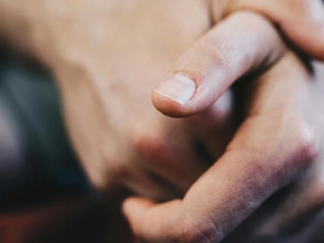 Móng tay nhợt nhạt, tái xanh có thể là do thiếu máu và ô xy trong máu. ẢNH: PEXELS Móng tay nhợt nhạt, tái xanh có thể là do thiếu máu và ô xy trong máu. ẢNH: PEXELS