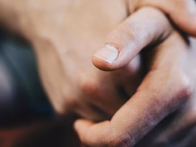 Móng tay nhợt nhạt, tái xanh có thể là do thiếu máu và ô xy trong máu. ẢNH: PEXELS