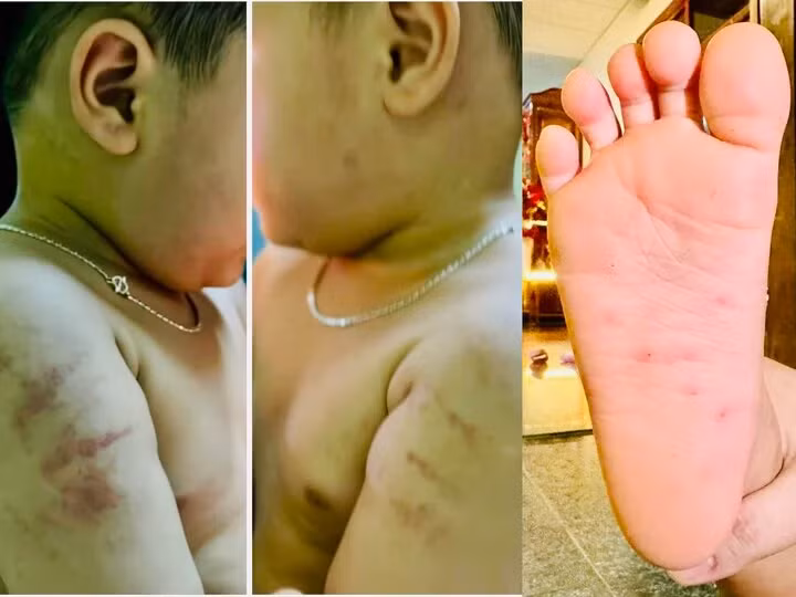 Hình ảnh các bé bị bạo hành được gia đình tố cáo trên mạng xã hội ngày 6/3.