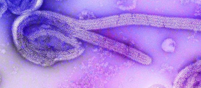 Hình ảnh virus Marburg Hình ảnh virus Marburg