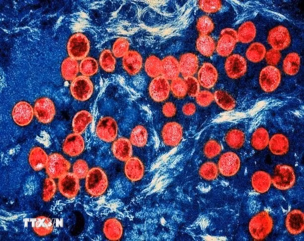 Hình ảnh virus đậu mùa khỉ dưới kính hiển vi. (Ảnh: Getty Images/TTXVN)