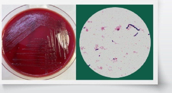 TP.HCM: Một người đàn ông nhiễm vi khuẩn liên cầu lợn - Ảnh 1. Phương pháp chẩn đoán vi sinh liên cầu lợn. Ảnh: BSCC