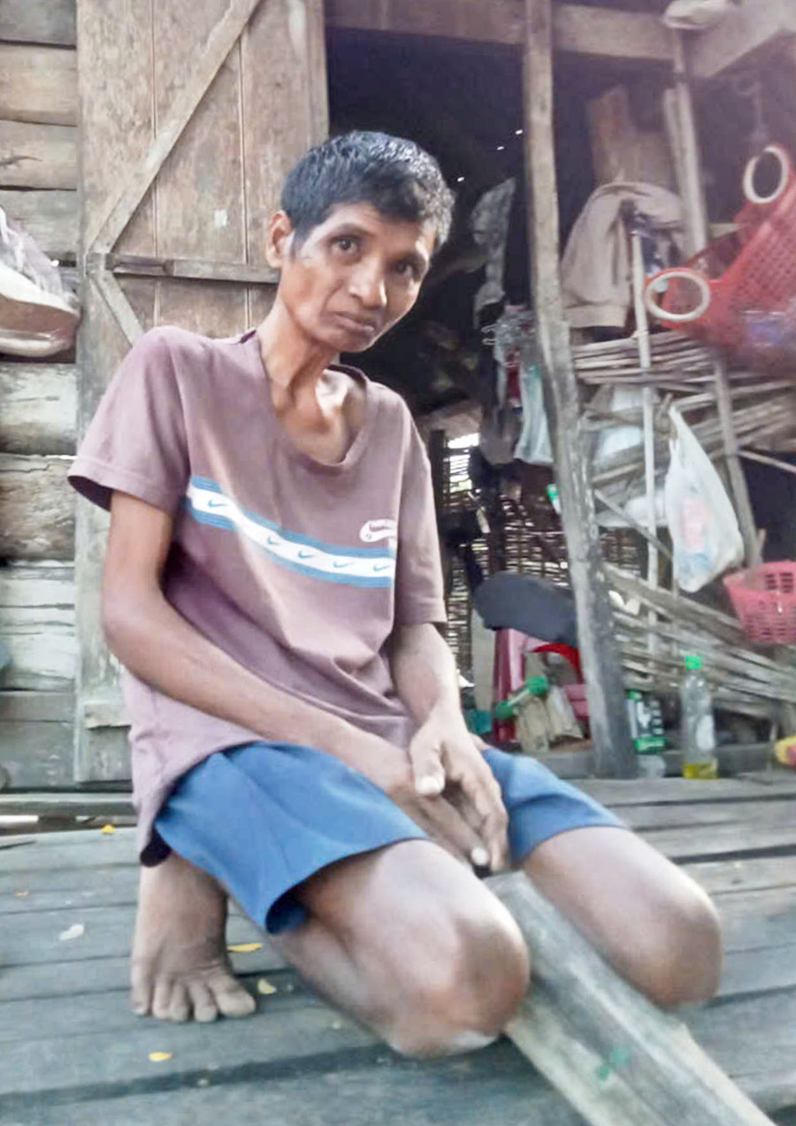 Mang nhiều bệnh trong người, anh Ksor Loai đã hoàn toàn mất sức lao động. Ảnh: Đ.P Mang nhiều bệnh trong người, anh Ksor Loai đã hoàn toàn mất sức lao động. Ảnh: Đ.P