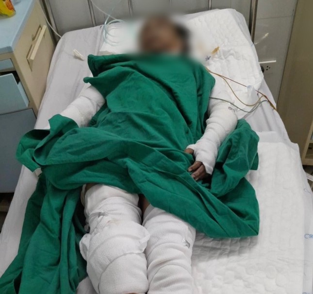 Các nạn nhân đang được các bác sĩ tích cực điều trị Các nạn nhân đang được các bác sĩ tích cực điều trị