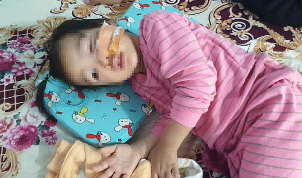 Bé A.D bị hai con chó becgie nhà hàng xóm cắn bị thương. (Ảnh: Đậu Tất Thành/TTXVN) Bé A.D bị hai con chó becgie nhà hàng xóm cắn bị thương. (Ảnh: Đậu Tất Thành/TTXVN)