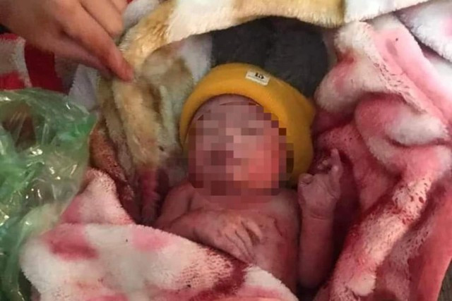 Cháu bé bị bỏ rơi được tìm thấy hôm 15.5 tại xã Ea Tu. Ảnh: NGƯỜI DÂN CUNG CẤP