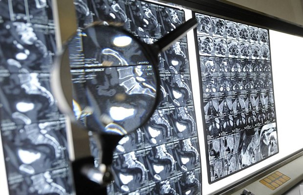 Phim chụp của một bệnh nhân ung thư. (Nguồn: TASS) Phim chụp của một bệnh nhân ung thư. (Nguồn: TASS)