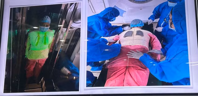 Phương pháp xạ trị toàn thân TBI. Ảnh: BVCC