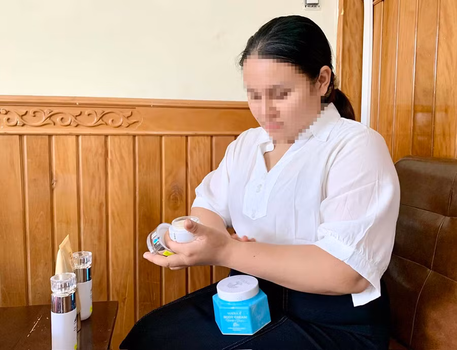 Bà Lê Thị Bích Nga cho biết, sau khi chăm sóc da mặt tại Spa Ruby và dùng bộ sản phẩm do cơ sở này cung cấp thì da bị kích ứng, ngứa và nổi mẩn đỏ. Ảnh: N.N