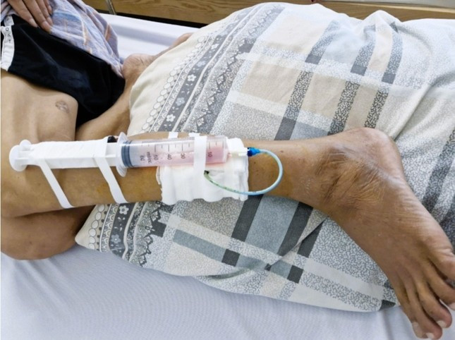 Bệnh nhân khi đến bệnh viện đã tổn thương rất nhiều cơ quan. Bệnh nhân khi đến bệnh viện đã tổn thương rất nhiều cơ quan.