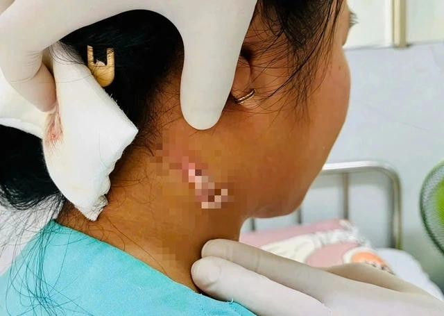 Hiện tại sức khỏe bệnh nhân ổn, được cách ly và theo dõi tại bệnh viện Hiện tại sức khỏe bệnh nhân ổn, được cách ly và theo dõi tại bệnh viện