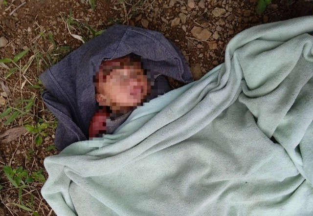 Bé gái sơ sinh bị bỏ rơi giữa rừng keo, kiến bu quanh người. ẢNH: CTV