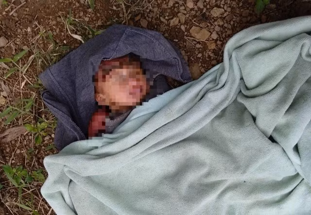Bé gái sơ sinh bị bỏ rơi giữa rừng keo, kiến bu quanh người. ẢNH: CTV