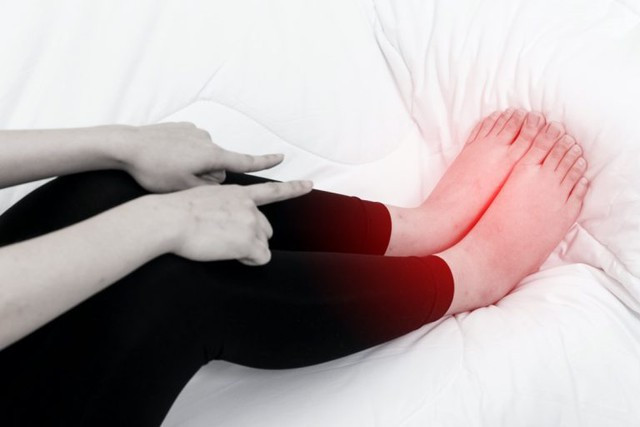 3 dấu hiệu kèm theo sưng chân cần đến bệnh viện kiểm tra ngay - Ảnh 2. Bàn chân, cẳng chân sưng kèm theo da ấm, nóng hơn bình thường có thể là dấu hiệu bất thường. Ảnh: SHUTTERSTOCK