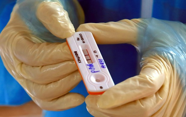 Kết quả xét nghiệm COVID-19. (Nguồn: Vietnam+) Kết quả xét nghiệm COVID-19. (Nguồn: Vietnam+)