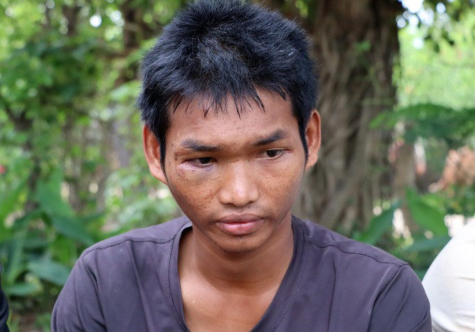Anh Y Dũn Bkrông kể lại việc bị bắt làm con tin suốt 4 ngày Anh Y Dũn Bkrông kể lại việc bị bắt làm con tin suốt 4 ngày