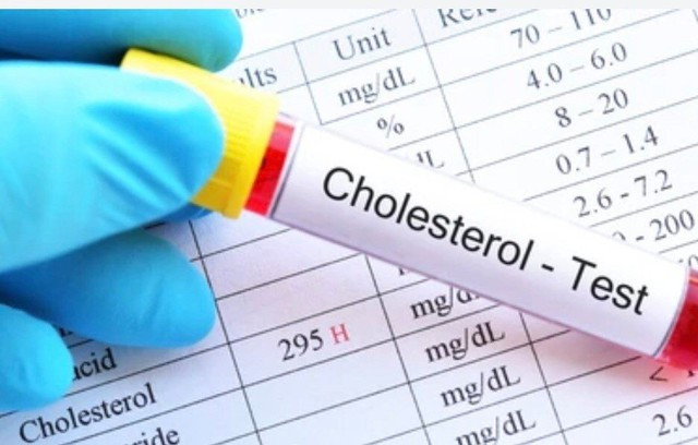 Kiểm soát hàm lượng cholesterol trong máu để giảm thiểu nguy cơ đột quỵ. Ảnh: Shutterstock