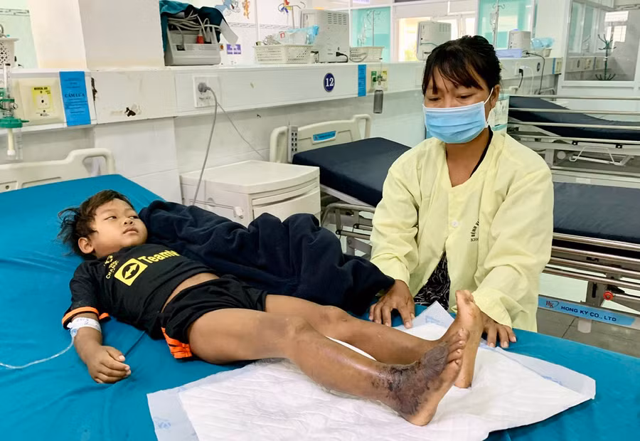 Chị Đinh Thị A chăm sóc con trai bị rắn độc cắn, hiện đang điều trị tại Bệnh viện Nhi tỉnh. Ảnh: N.N Chị Đinh Thị A chăm sóc con trai bị rắn độc cắn, hiện đang điều trị tại Bệnh viện Nhi tỉnh. Ảnh: N.N