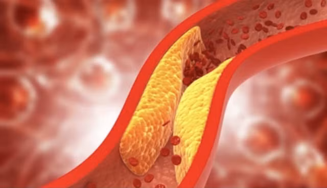 Việc tăng lượng omega-3 thông qua chế độ ăn uống cũng có thể giúp kiểm soát mức cholesterol. Ảnh: SHUTTERSTOCK