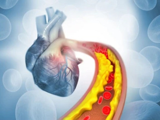 Tỏi mật ong có thể bảo vệ tim, giảm nguy cơ mắc bệnh tim và đột quỵ. Ảnh: Shutterstock Tỏi mật ong có thể bảo vệ tim, giảm nguy cơ mắc bệnh tim và đột quỵ. Ảnh: Shutterstock