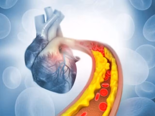 Tỏi mật ong có thể bảo vệ tim, giảm nguy cơ mắc bệnh tim và đột quỵ. Ảnh: Shutterstock