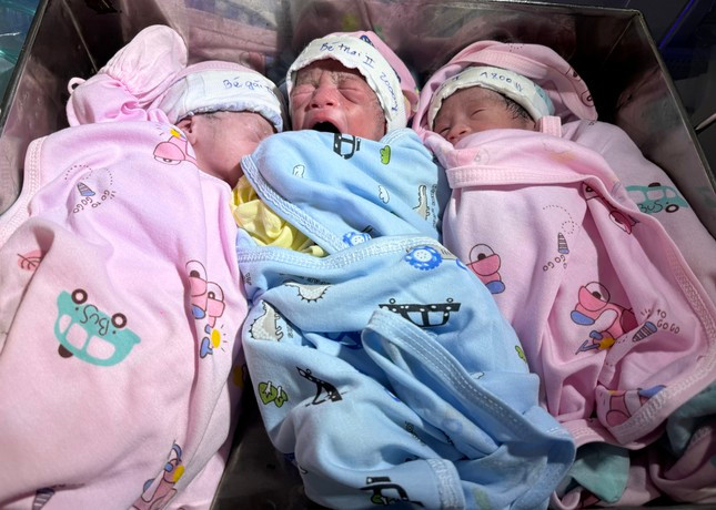 Ba em bé chào đời khỏe mạnh. Ảnh: PN Ba em bé chào đời khỏe mạnh. Ảnh: PN