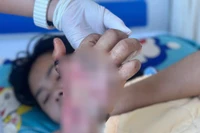 Vụ lật xe ô tô chở học sinh ở Chư Prông: 1 học sinh vẫn đang tiếp tục được điều trị