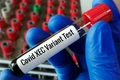 Xét nghiệm biến thể Xec của Covid (Nguồn: Quatidiano.net)