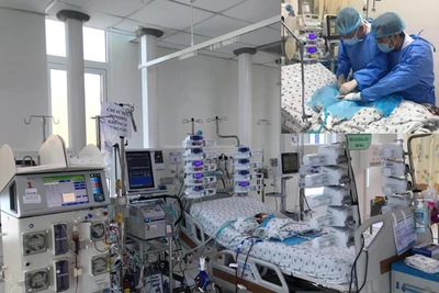 Vừa ECMO vừa lọc máu liên tục, cứu bé sơ sinh nguy kịch sau mổ tim bẩm sinh