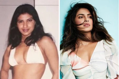 Hoa hậu Thế giới Priyanka Chopra gây sốc với ảnh thời chưa 'dao kéo'