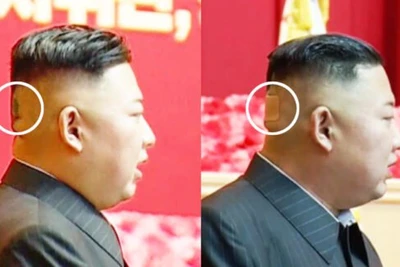 Ông Kim Jong-un bất ngờ xuất hiện với băng dán sau đầu