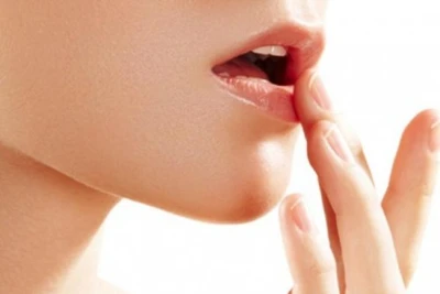 Mùa hè, chăm sóc môi thế nào?
