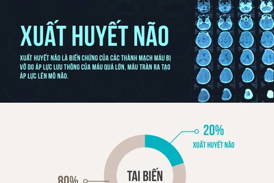 Xuất huyết não khởi điểm từ đâu?