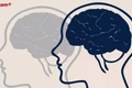 Phát triển công nghệ giải mã 'độc thoại nội tâm,' biến suy nghĩ thành lời nói