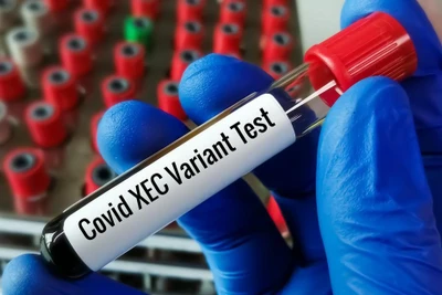 Xét nghiệm biến thể Xec của Covid (Nguồn: Quatidiano.net)