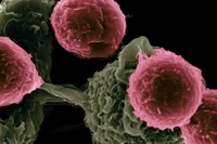 Australia phát triển liệu pháp miễn dịch mới cho ung thư máu hiếm gặp