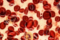 Biến thể gene hiếm chống ung thư máu mở ra hướng điều trị mới