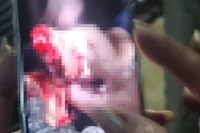 Nhóm côn đồ hung hãn vào phòng trọ chém đứt lìa tay người khác