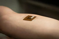 Độc đáo miếng dán phát hiện ung thư da